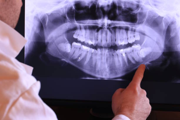 Best Urgent Care for Lost Fillings or Crowns in South Beach, FL